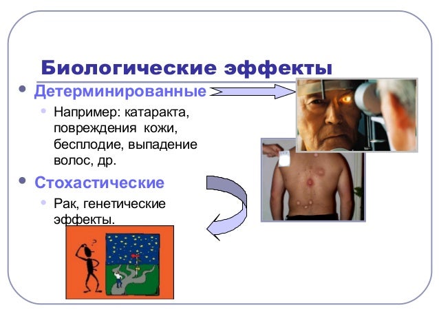 Детерминированный и стохастический эффект реферат 5969